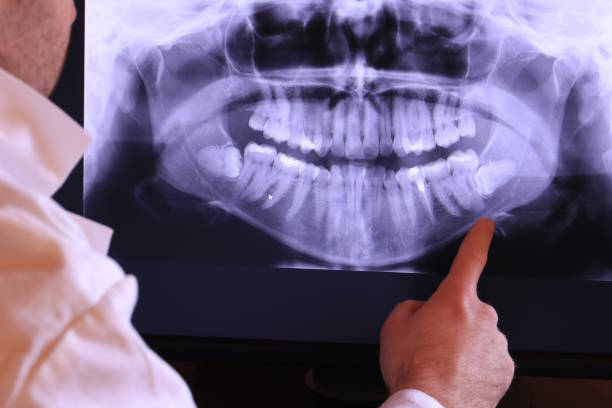 Best Chipped Tooth Repair Near Me  in Hazardville, CT